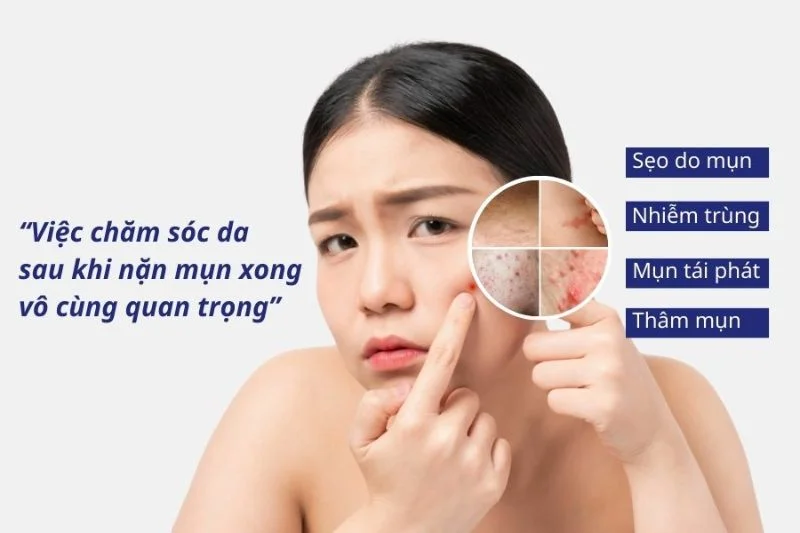 Nguyên Nhân Mụn Thâm Và Cách Phòng Ngừa Tái Thâm Hiệu Quả 2 phong ngua mun tham