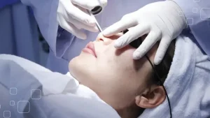 Giải pháp điều trị sẹo rỗ chuyên sâu: từ TCA đến Laser Fractional CO₂ spa fresh banana