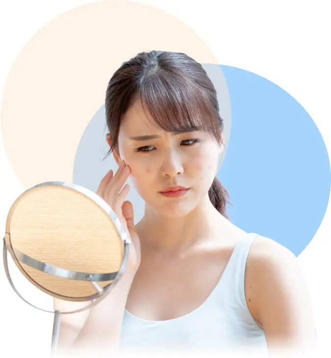 giai thich peel da tri mun tham la gi