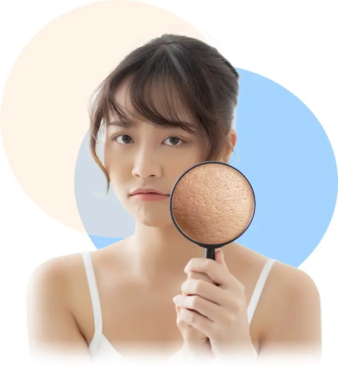 Điều trị lỗ chân lông và làm trắng sáng da tại Spa Fresh Banana Gò Vấp