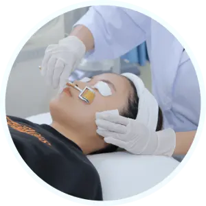 lăn kim trị sẹo rỗ spa fresh banana gò vấp