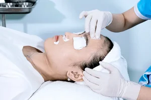 Hình ảnh quy trình TCA trị sẹo rỗ tại Fresh Banana