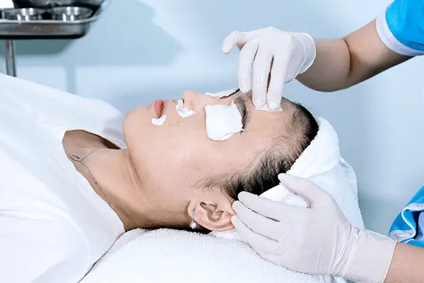 Phân biệt các loại sẹo rỗ, sẹo lõm và nguyên nhân hình thành 1 Hình ảnh quy trình TCA trị sẹo rỗ tại Fresh Banana