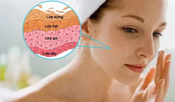 Cận cảnh tàn nhang trên da mặt