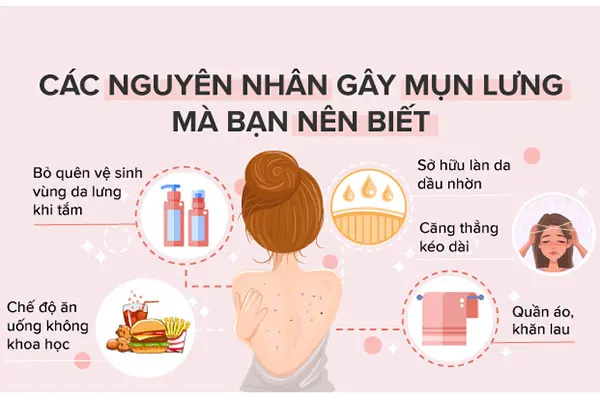 nguyen nhan gay mun lung: mo hoi, quan ao bi, da dau, cang thang, ve sinh kem, che do an uong