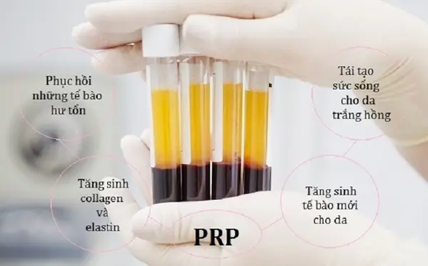 công nghệ prp spa fresh banana