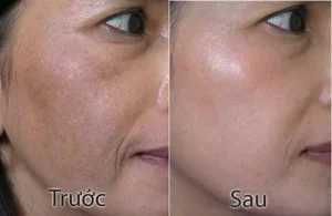 tri nam tan nhang 312 1 ngoisao.vn